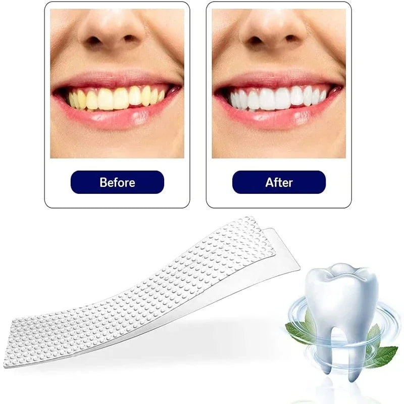 5D blanchiment des dents autocollants 7/14 paires Gel bandes de blanchiment élimination des taches hygiène buccale bande de soin outils de blanchiment dentaire dents